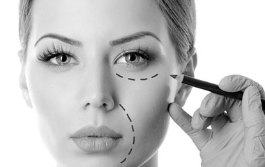 Facial cosmetic surgery