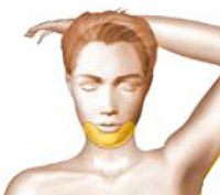 Lipomodelling operating diagram for the face in cosmetic surgery