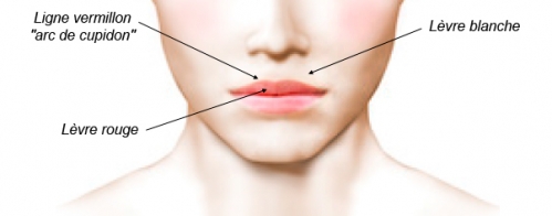 Operating diagram for lip surgery.
